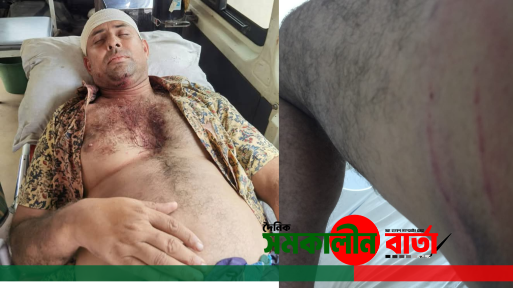 বরিশালে মাছের ঘের দখল নিয়ে সংঘর্ষ, বিএনপি নেতা মিন্টু মিয়া মুমূর্ষু অবস্থায়